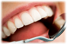 State of the Art Tooth Whitening